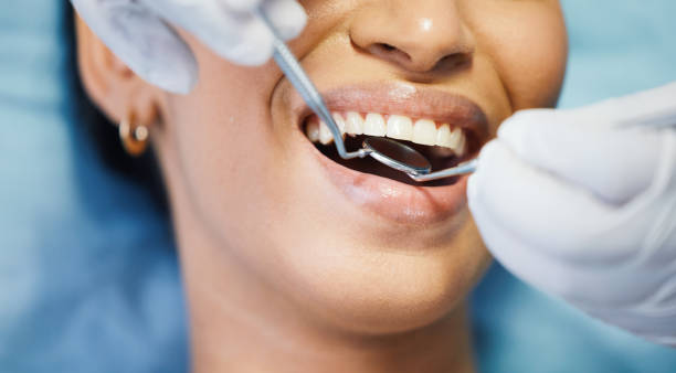 Best Dental Abscess Treatment in Nolensville, TN